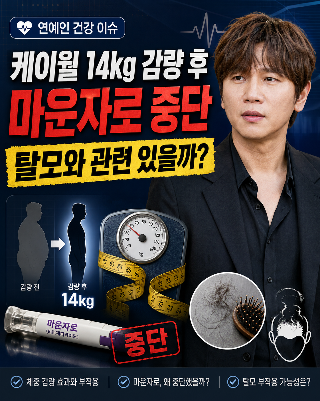 케이윌 14kg 감량 후 마운자로 중단, 탈모와 관계 있을까?